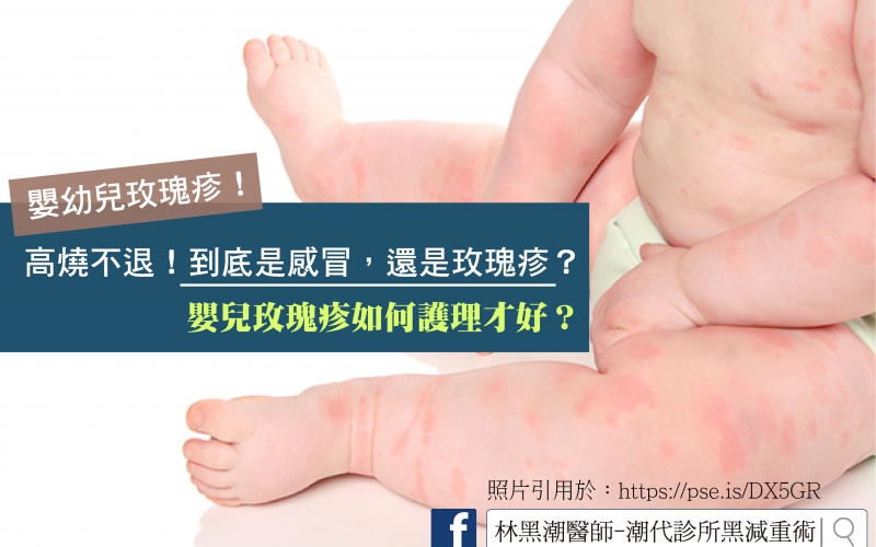 寶寶反覆發燒了？嬰幼兒玫瑰疹如何照護？／文：許錦銓醫師