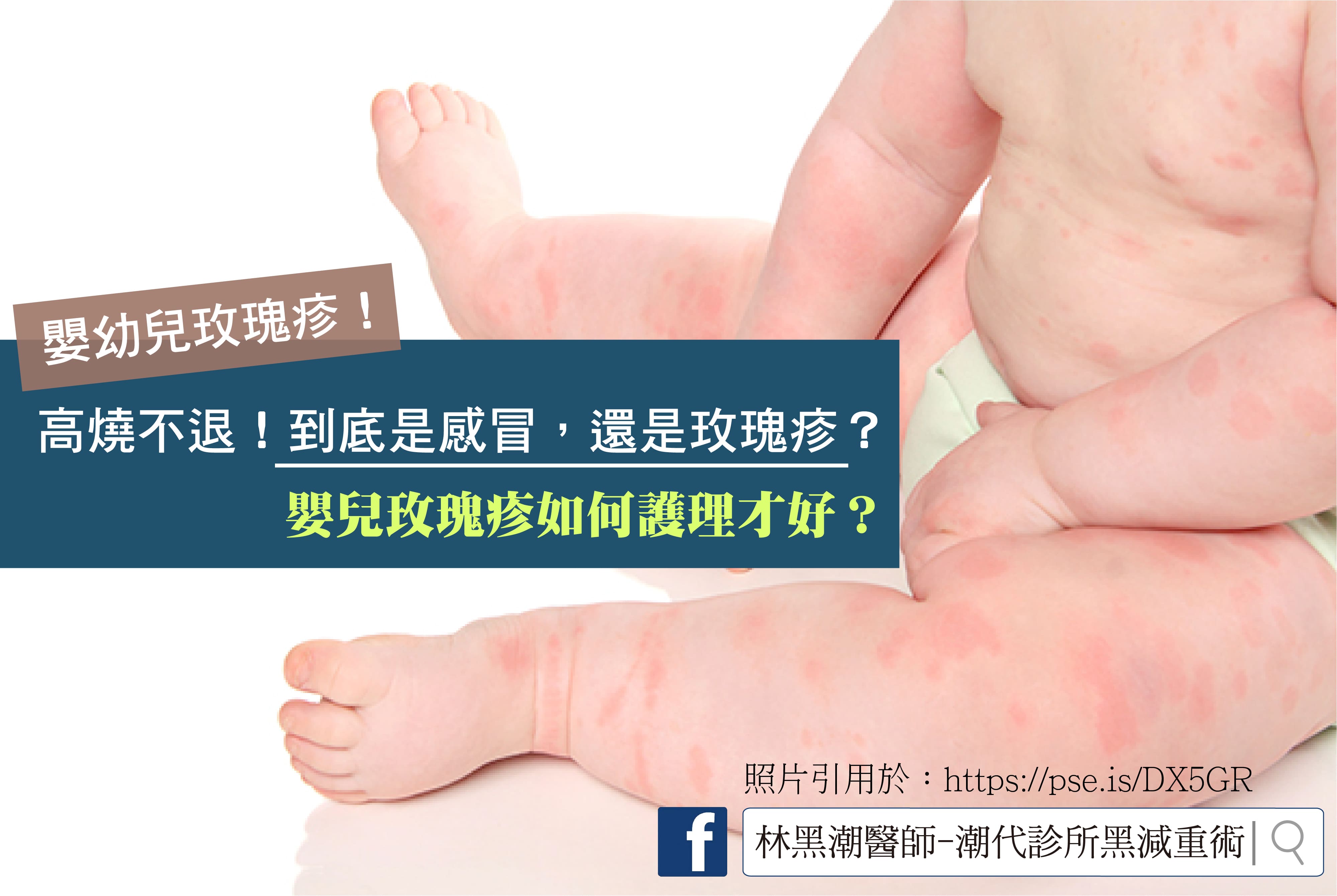 寶寶反覆發燒了？嬰幼兒玫瑰疹如何照護？／文：許錦銓醫師