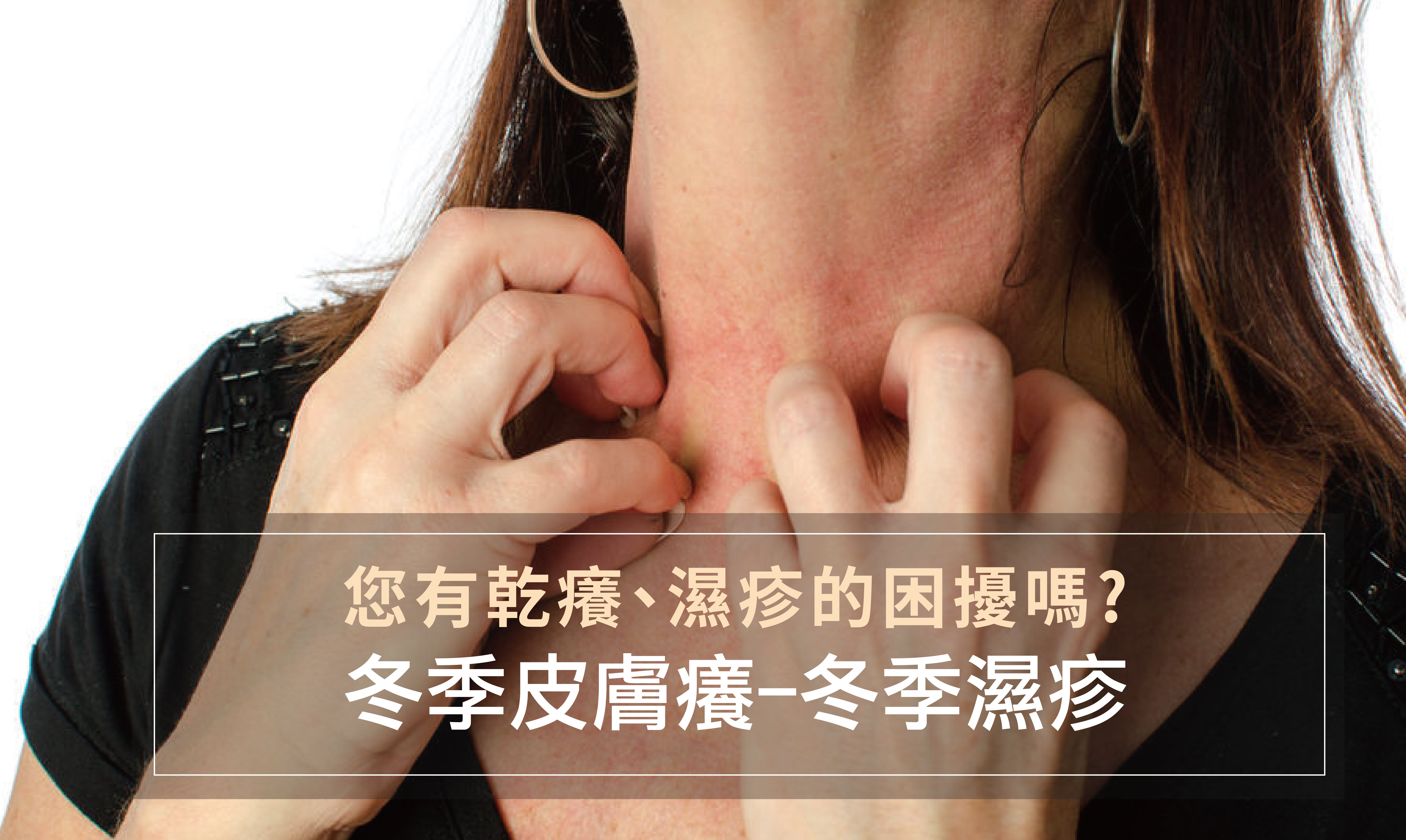 冬季皮膚癢-冬季濕疹/文：洪啟偉醫師