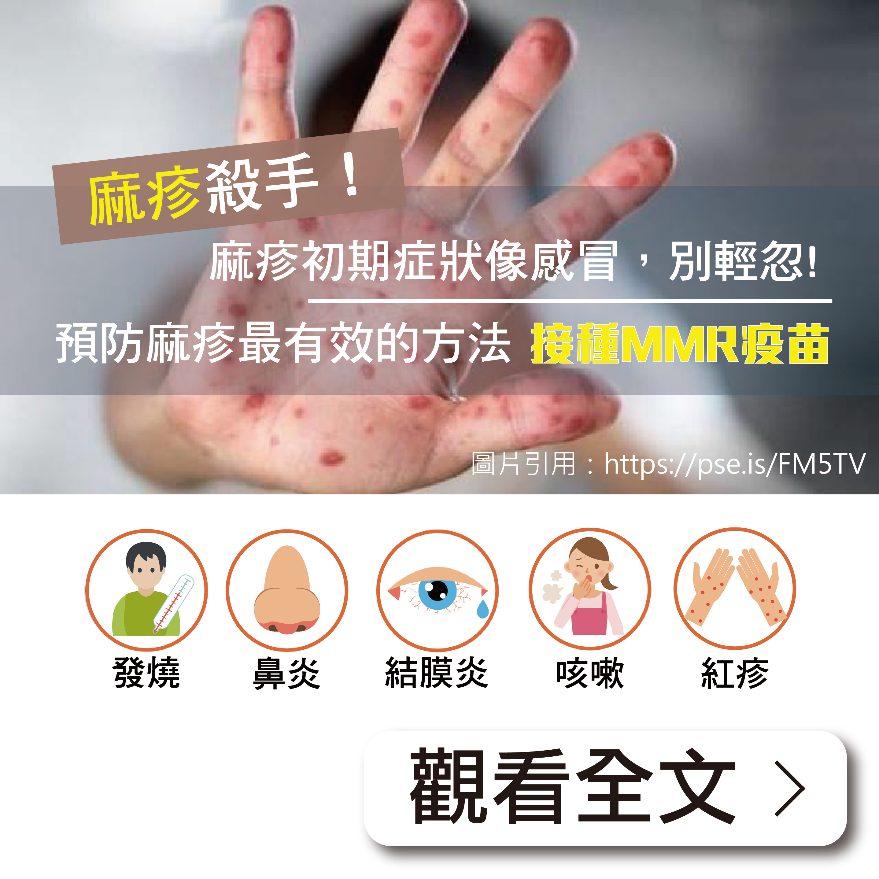 麻疹是什麼？施打疫苗可以預防嗎？／文：洪啟偉醫師