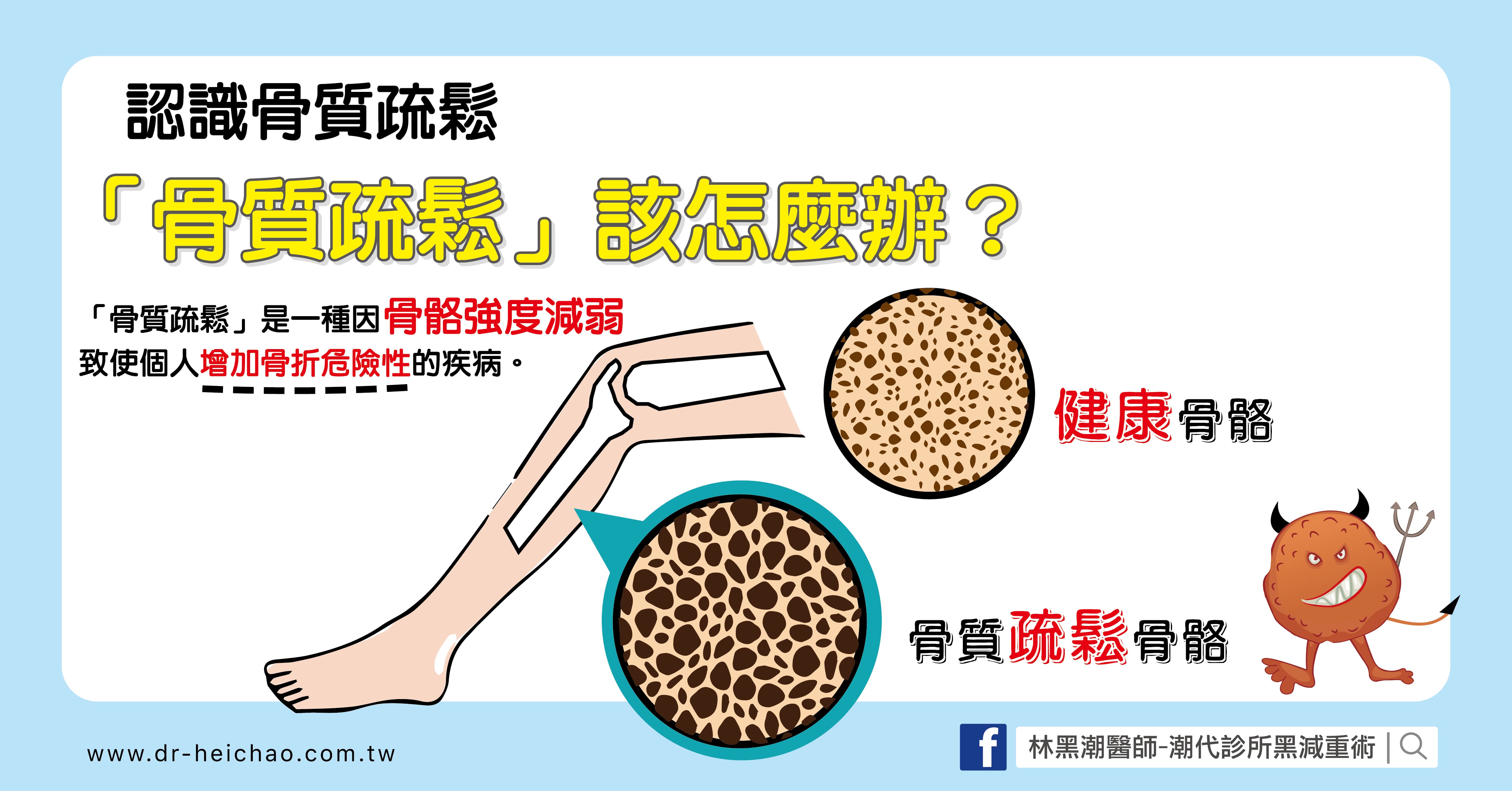 認識骨質疏鬆/文:王世杰醫師