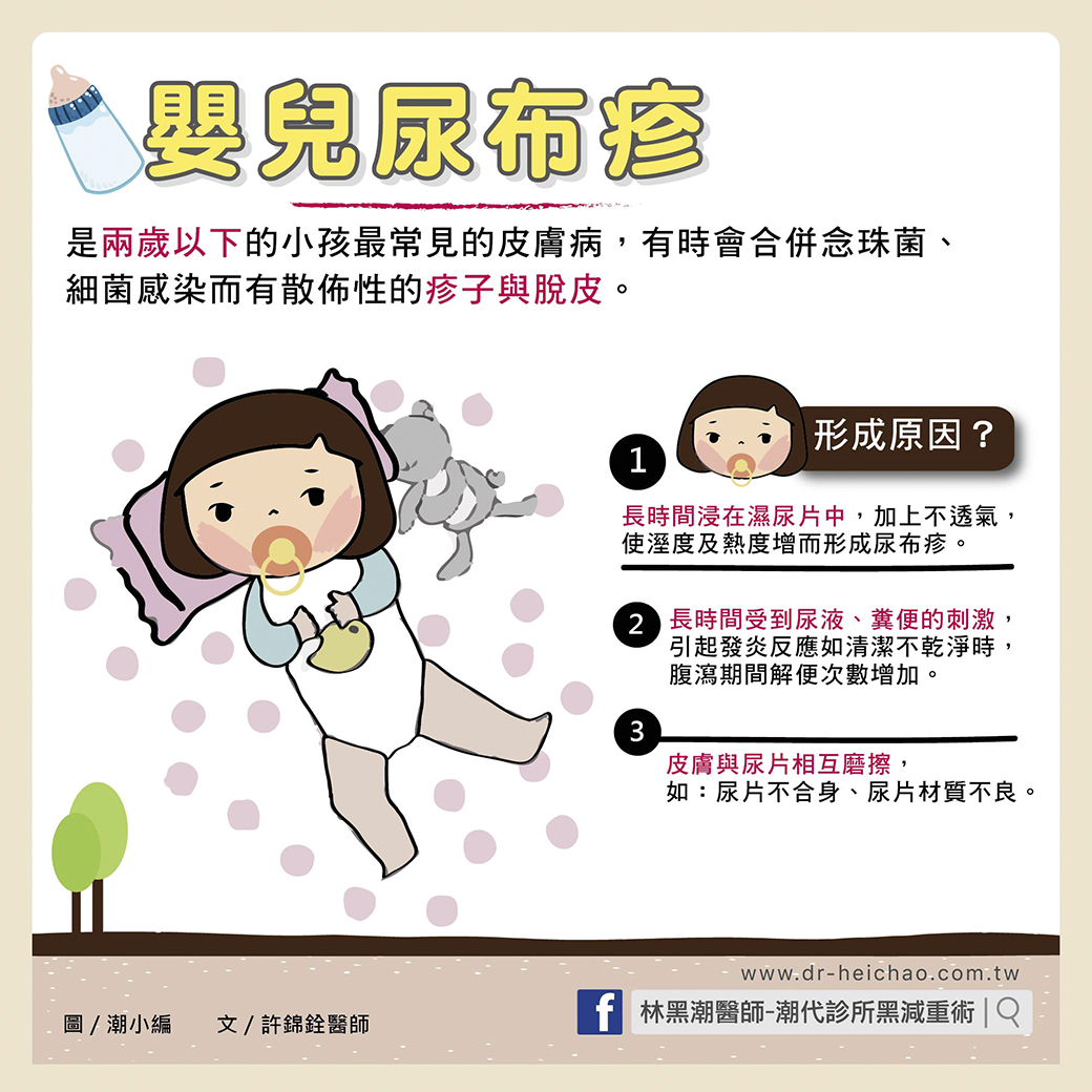 嬰兒紅屁屁怎麼辦？６招預防嬰兒尿布疹／文：許錦銓醫師