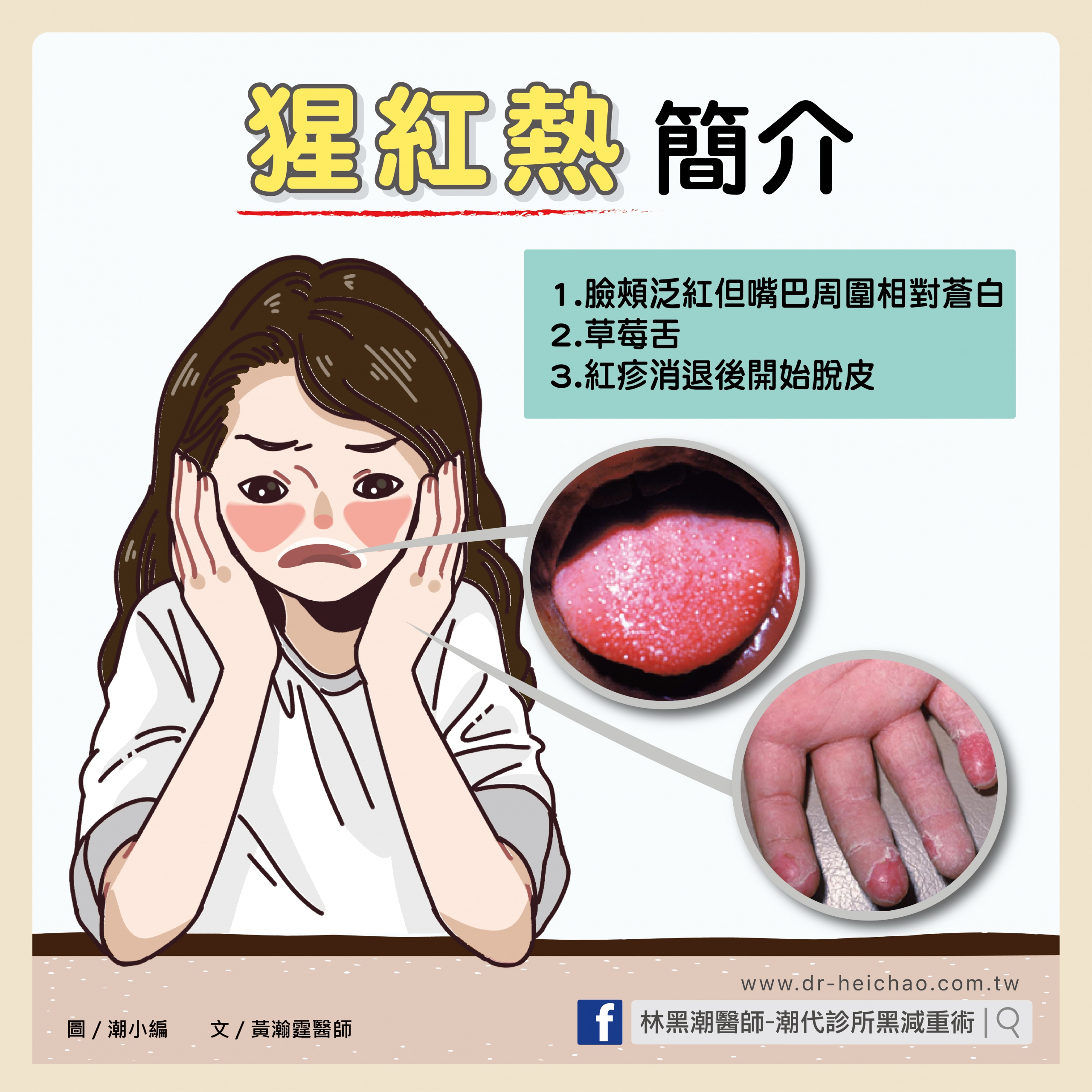 猩紅熱簡介/文:黃瀚霆醫師