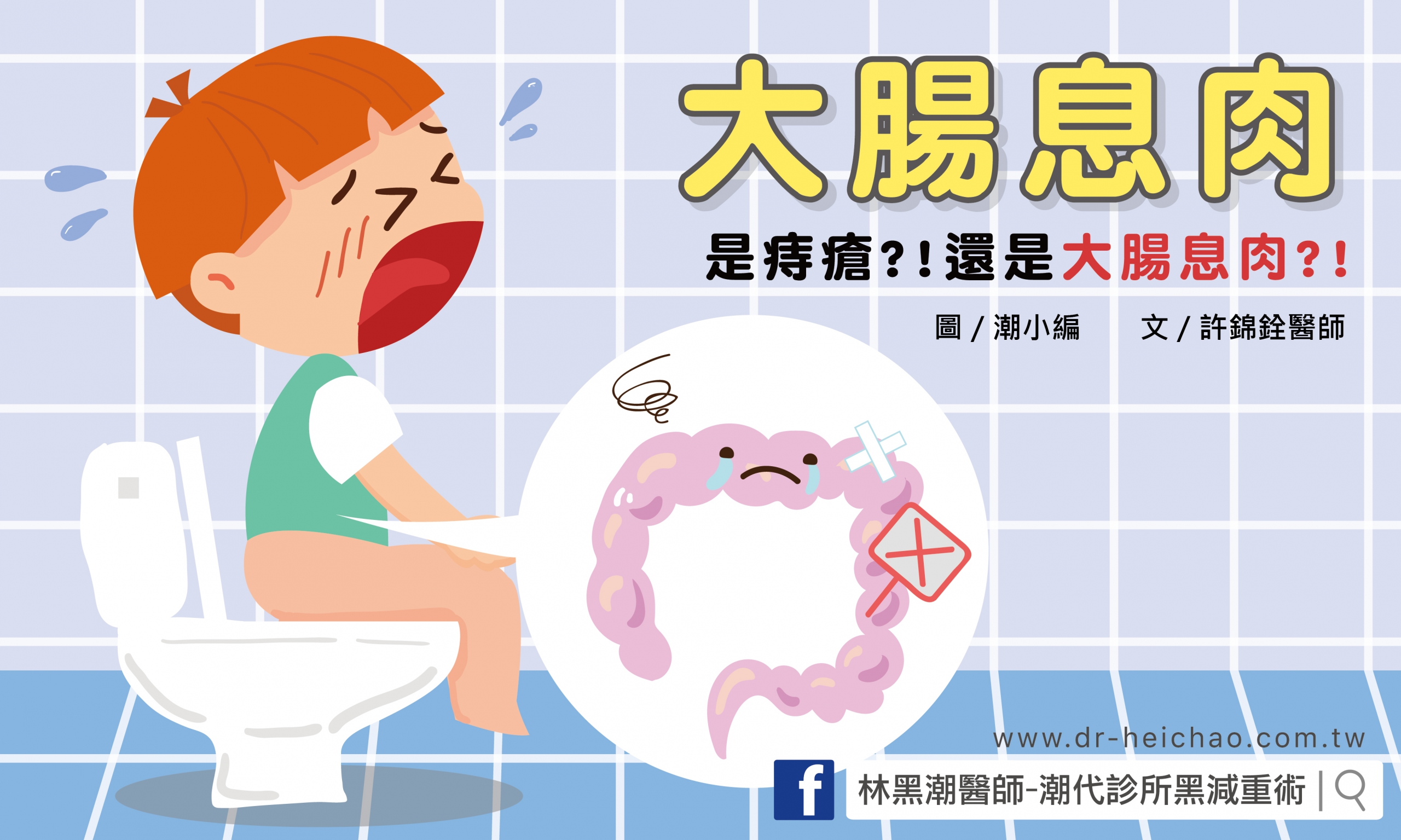 大腸息肉/文:許錦銓醫師
