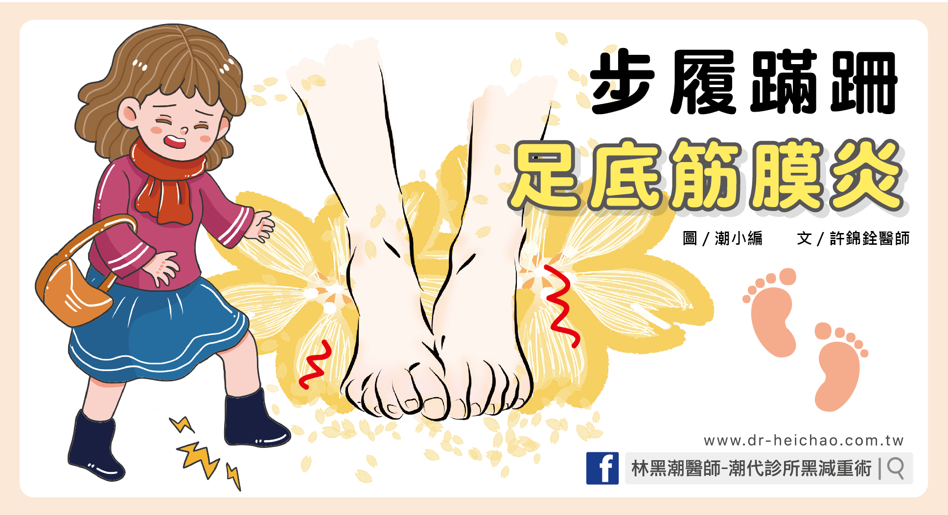 步履蹣跚足底筋膜炎／文：許錦銓醫師