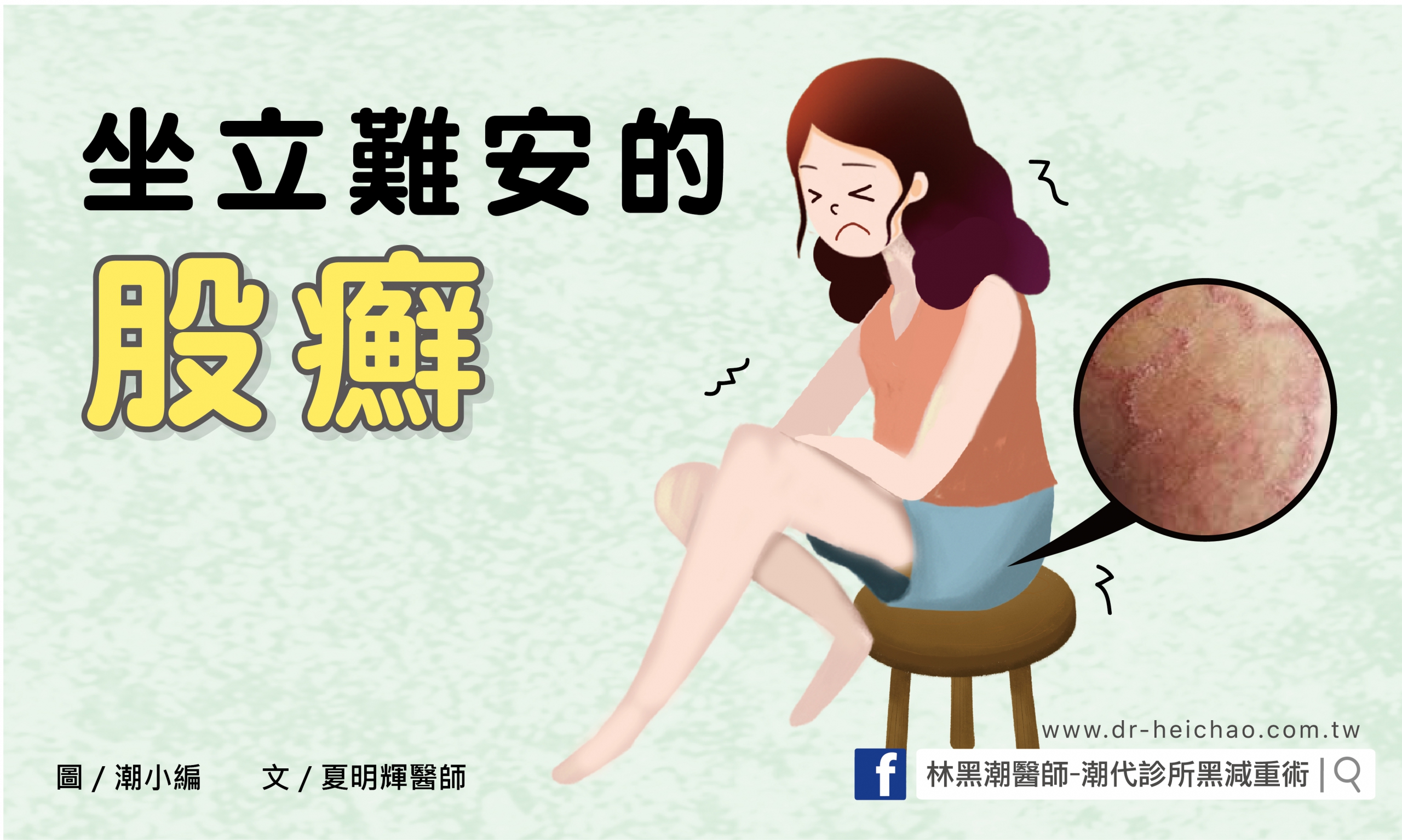 坐立難安的股癬／文：夏明輝醫師