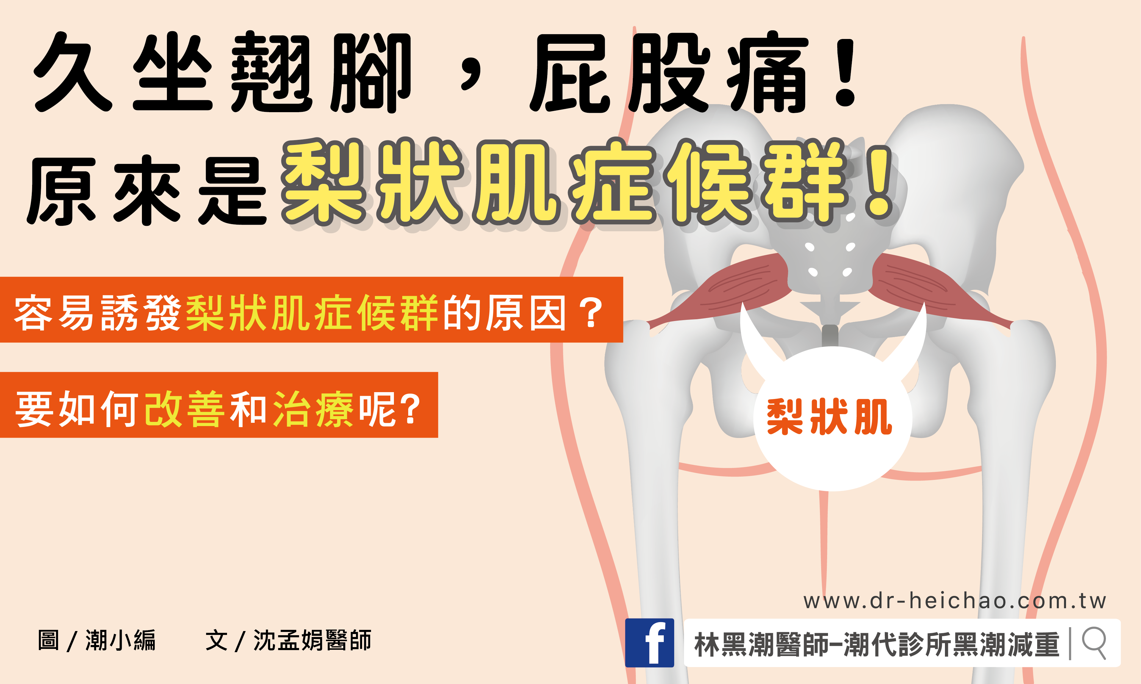 久坐翹腳，屁股痛！原來是梨狀肌症候群！／文：沈孟娟醫師